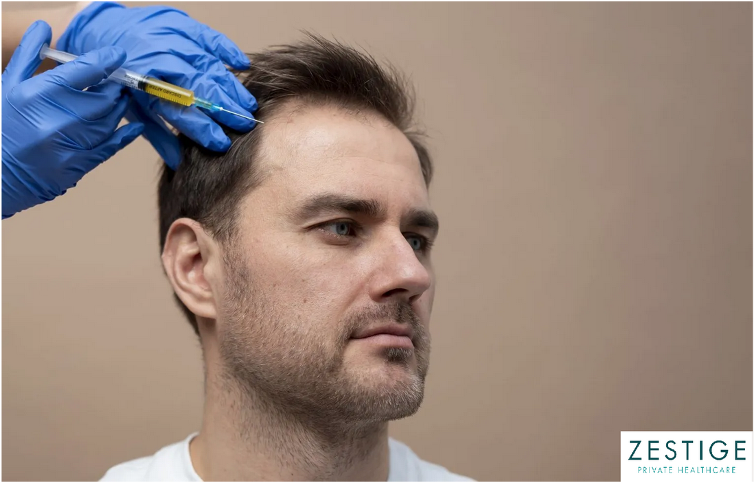 Is a Second Hair Transplant Necessary?