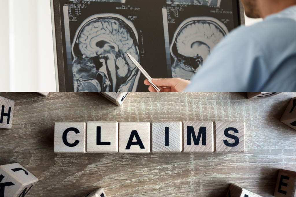5 Factors That Affect the Compensation in Brain Injury Lawsuits